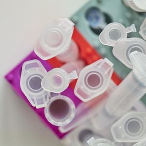 HbA1c: Das Blutzuckergedächtnis
